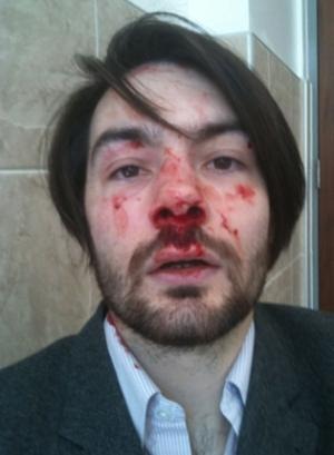 [blood[2].jpg]
