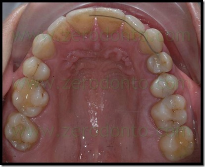 fig 20 fig 20