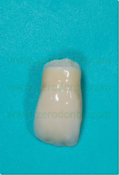 restauro zirconia