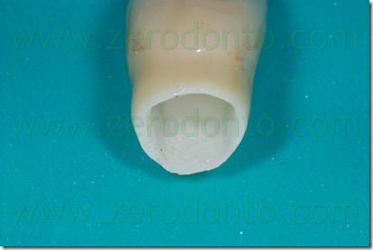 ricostruzione ceramica integrale