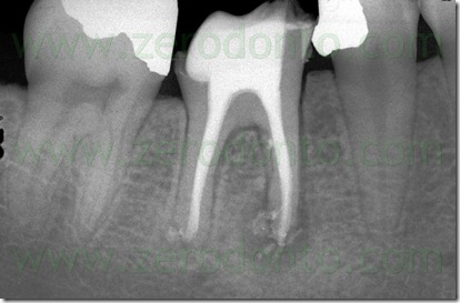 Fig. 03b Fig. 03b