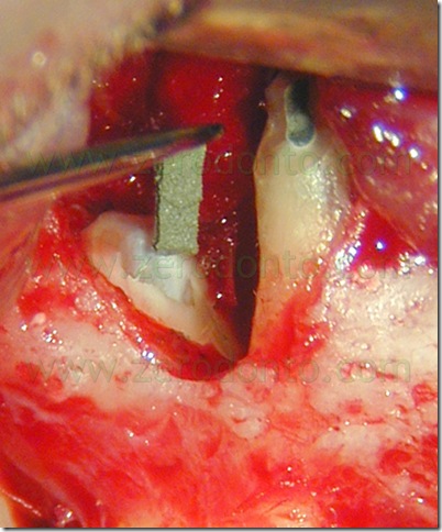 Fig. 43 Fig. 43
