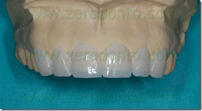 faccetta window