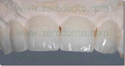 ceramica smalto