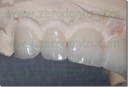 massa dentinale cermica