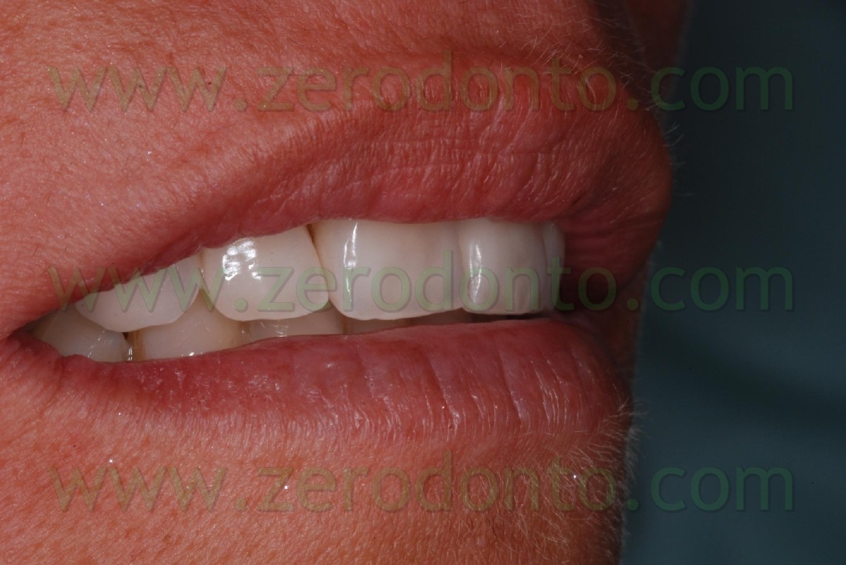 [DSC_5212[10].jpg]