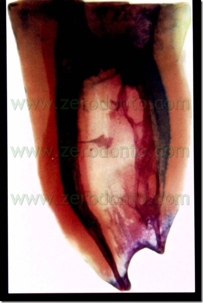 tetraclean