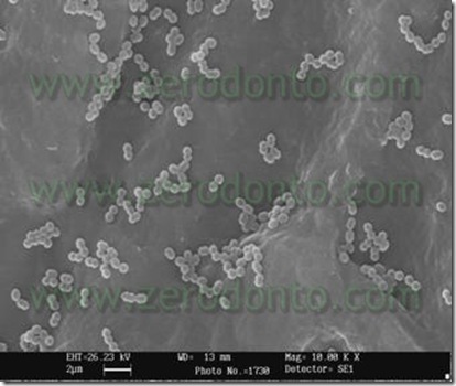 batteri endodontici