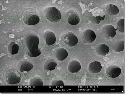 dentina radicolare