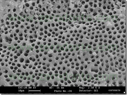 dentina endodonzia