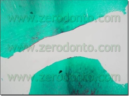 terapia endodontica
