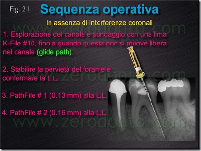 interferenze coronali interferenze coronali