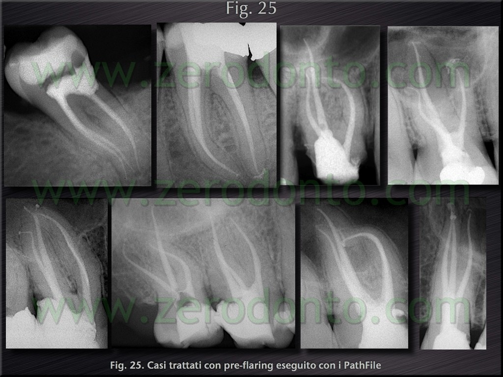 [Fig.25[4].jpg]