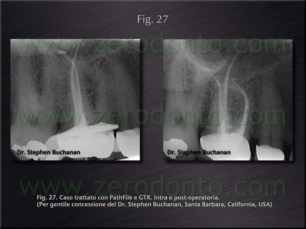 [Fig.27[4].jpg]