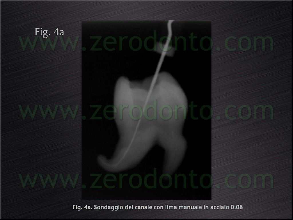 [Fig.4a[5].jpg]