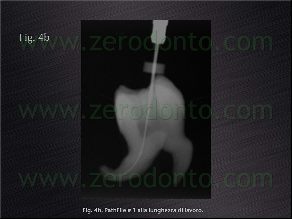 [Fig.4b[5].jpg]