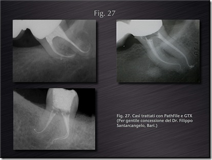 endodonzia berutti endodonzia berutti