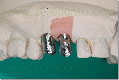 moncone angolato 2