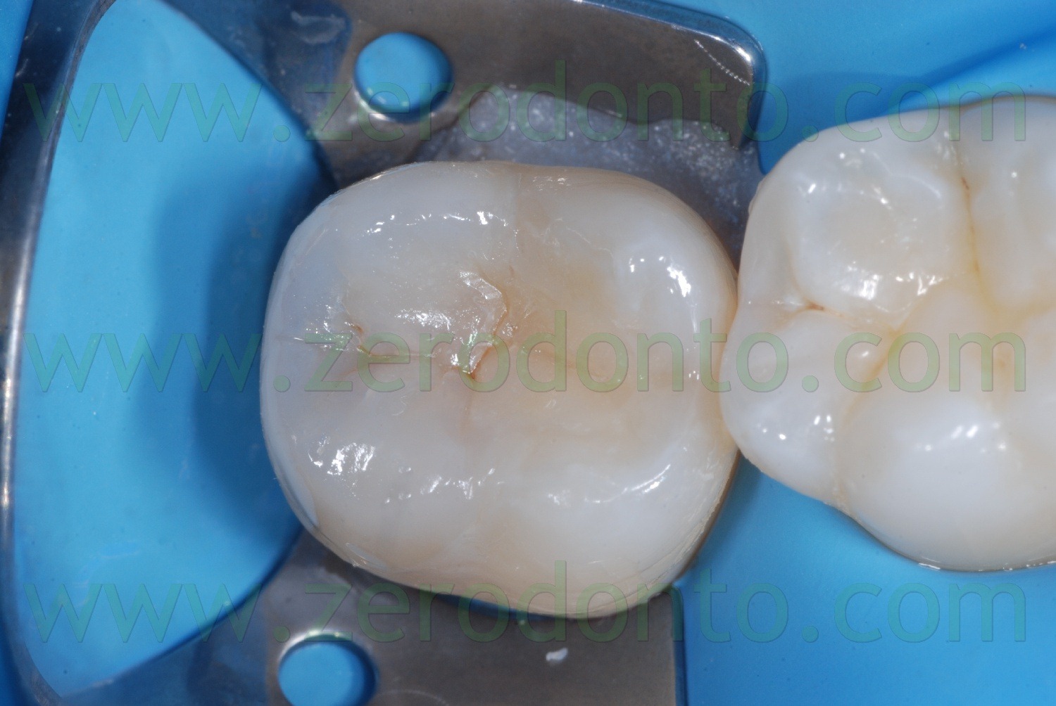 [Fig0069Rosti Q4[2].jpg]