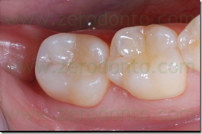 Fig0070Rosti Q4