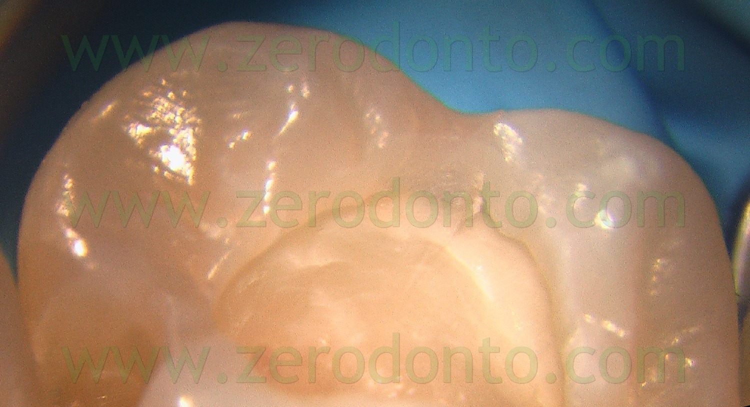 [Fig0051Rosti Q2[2].jpg]