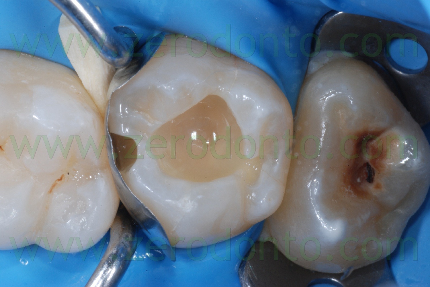[Fig0053Rosti Q2[2].jpg]