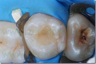Fig0056Rosti Q2