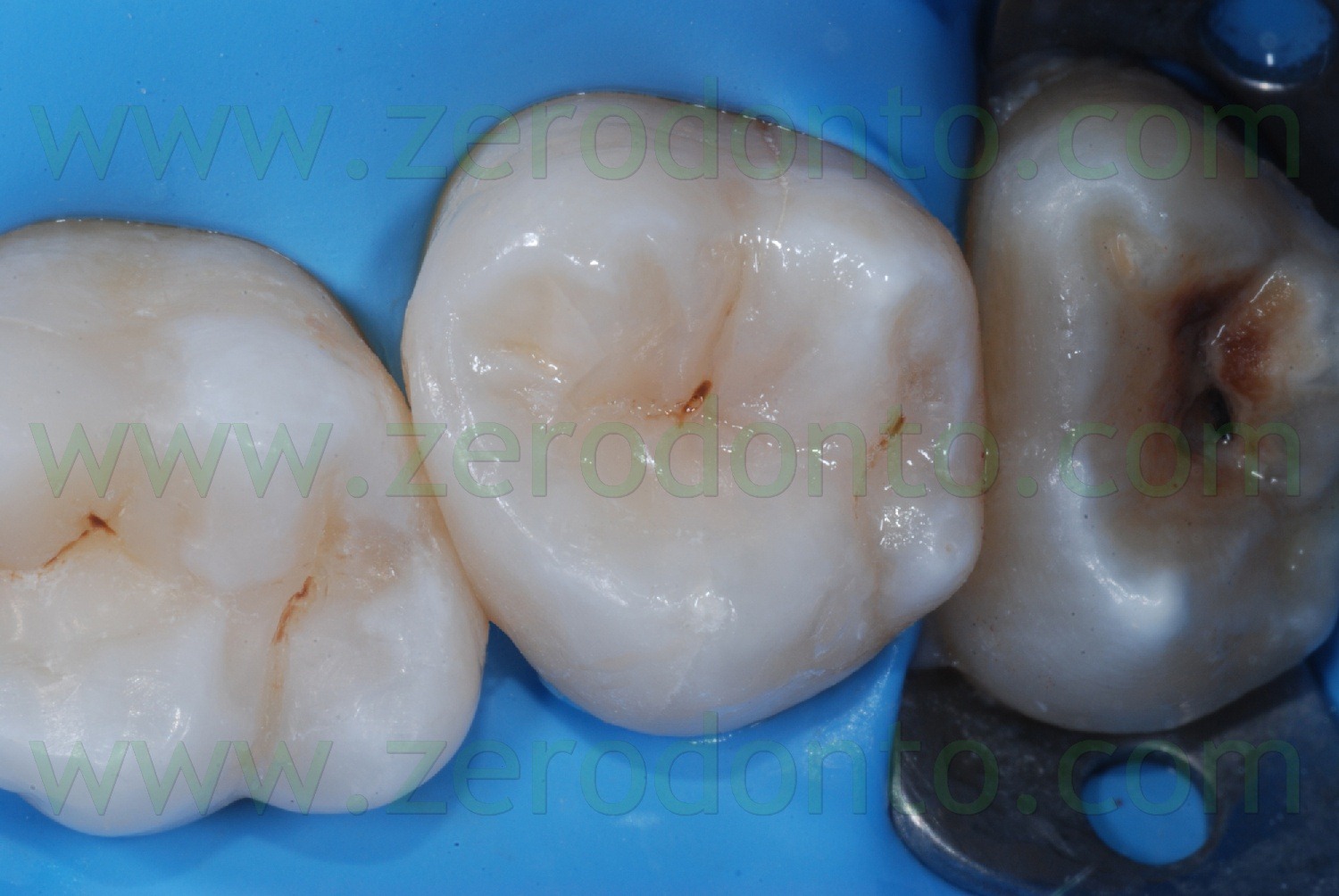 [Fig0060Rosti Q2[2].jpg]