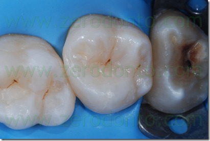 Fig0060Rosti Q2