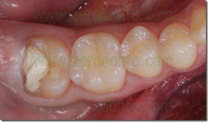 Fig0062Rosti Q4