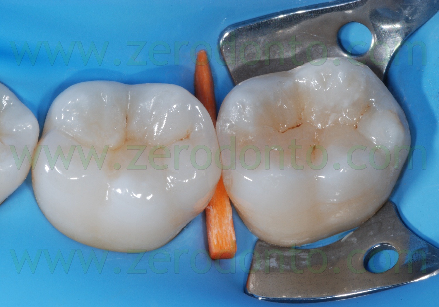 [Fig0092Rosti Q3[2].jpg]