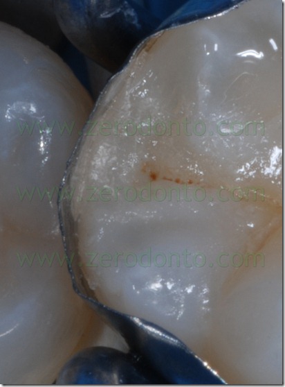 Fig0079Rosti Q4