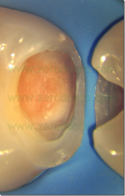 Fig0085Rosti Q3