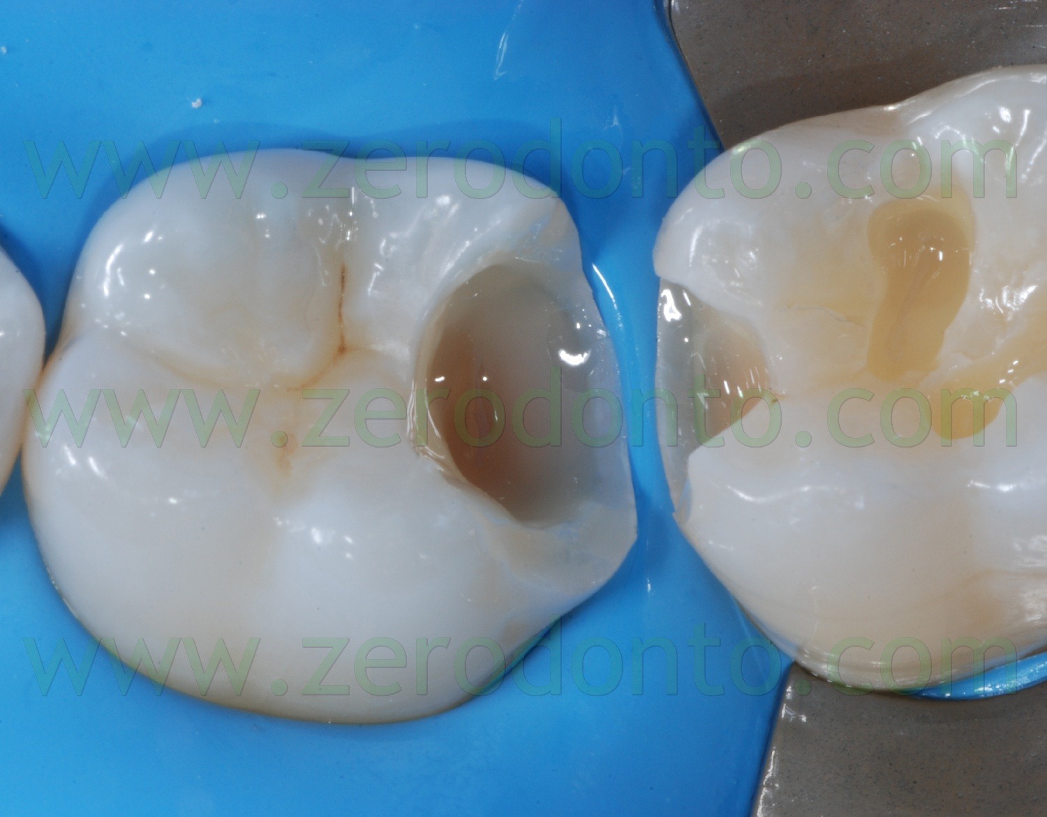 [Fig0086Rosti Q3[2].jpg]