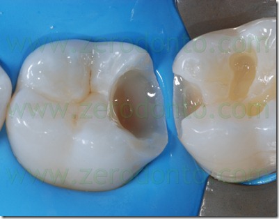 Fig0086Rosti Q3
