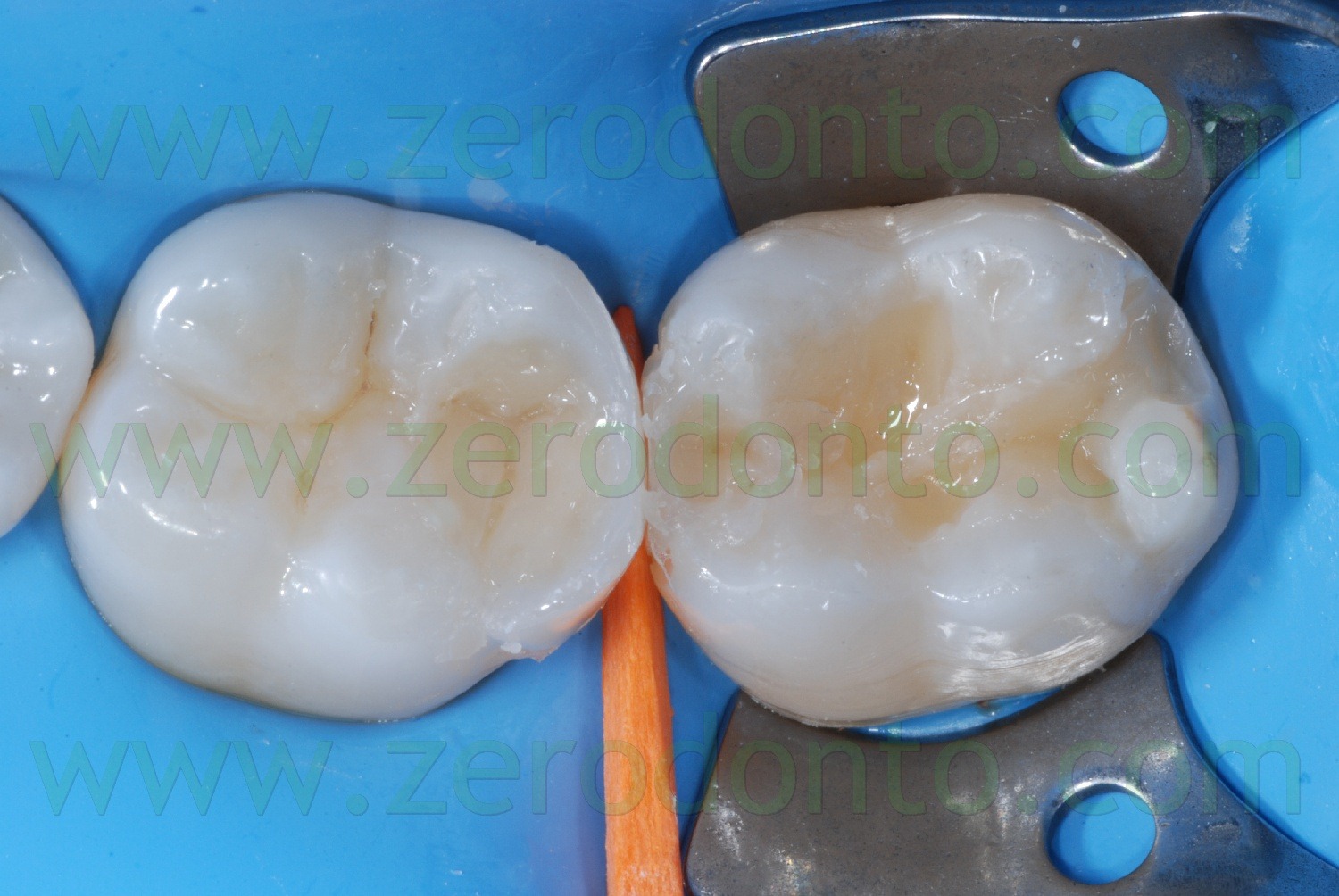 [Fig0090Rosti Q3[2].jpg]