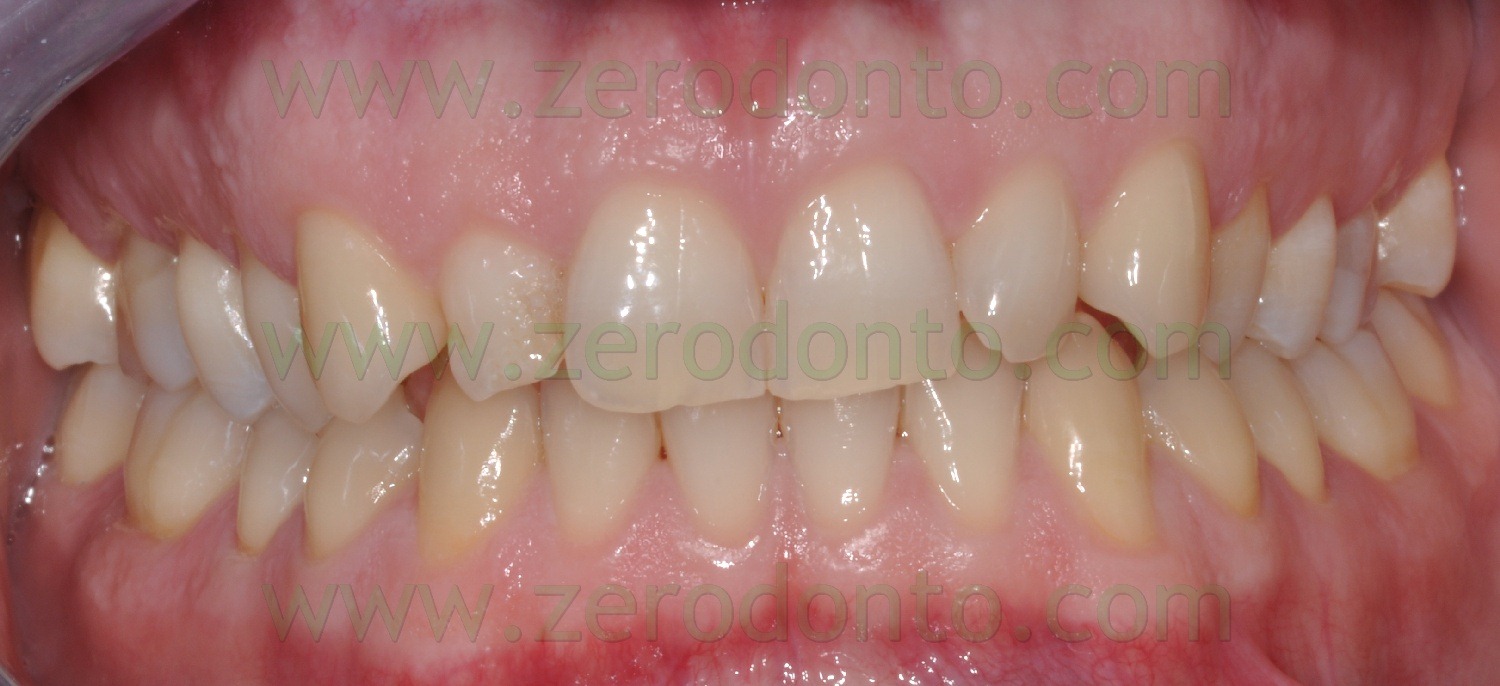[Fig0098Rosti recall1.5aa[2].jpg]