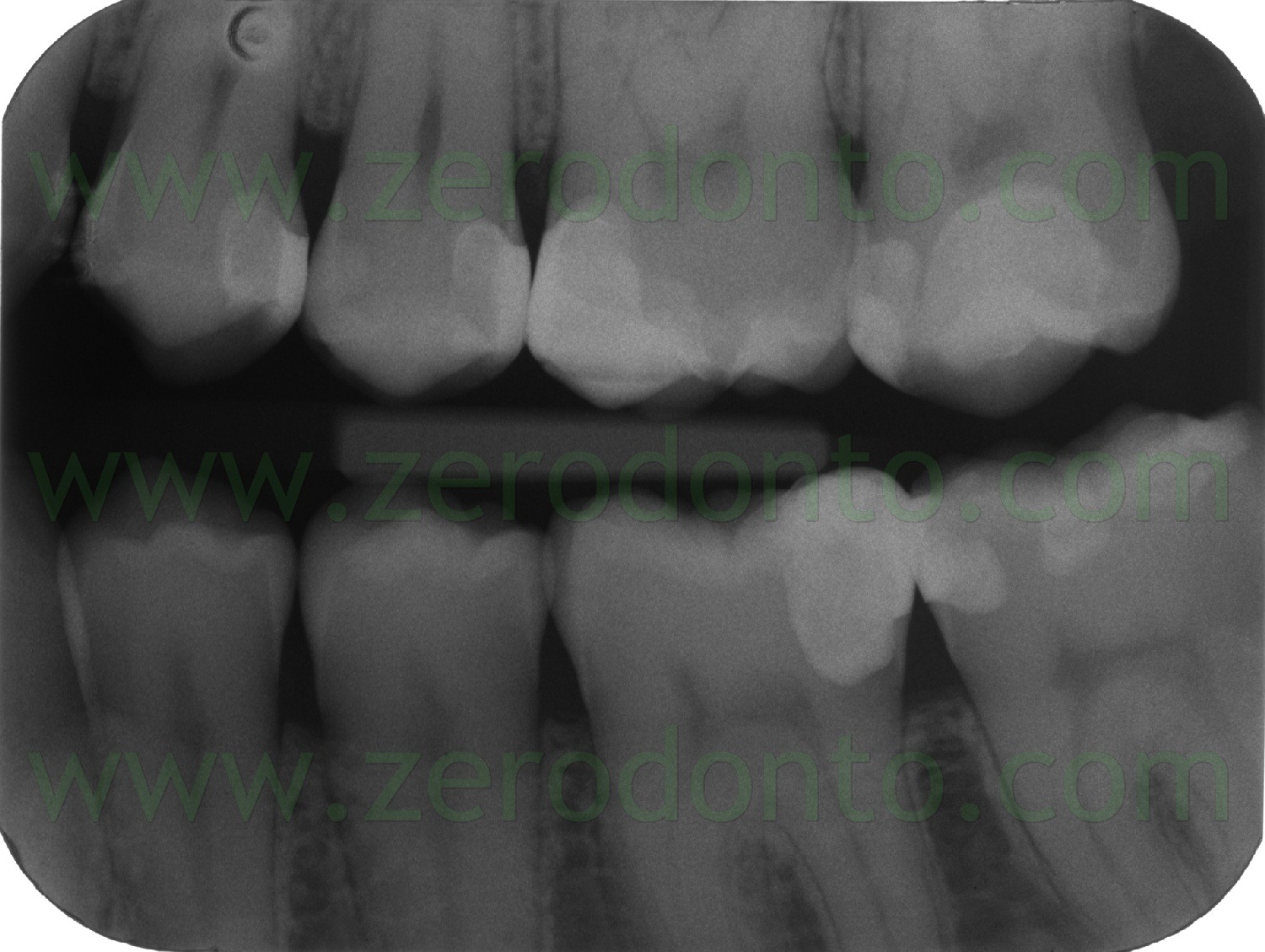 [Fig0099Rosti fin[2].jpg]