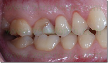Fig0005Rosti Q1