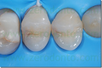 Fig0009Rosti Q1