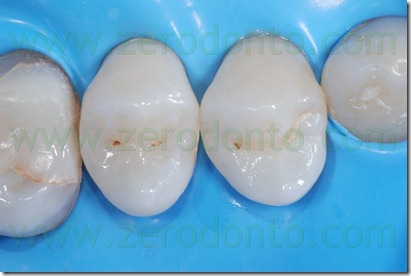 Fig0014Rosti Q1