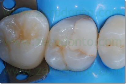 Fig0017Rosti Q1