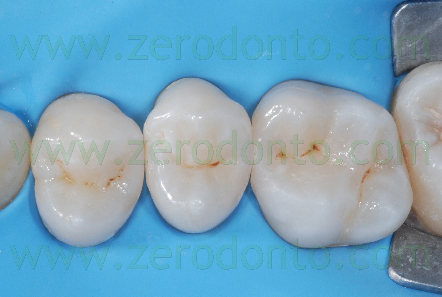 [Fig0048Rosti Q2[2].jpg]