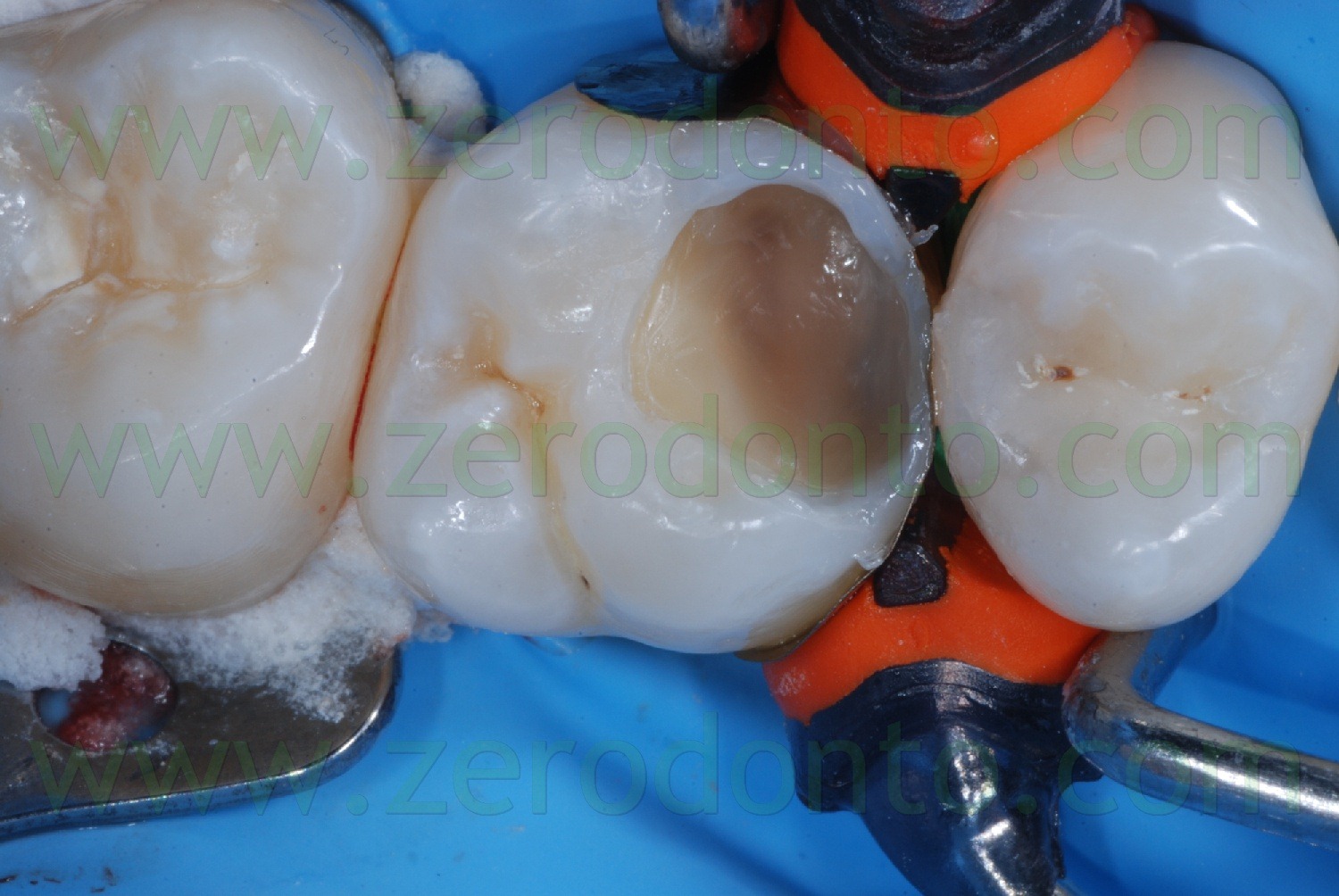 [Fig0034Rosti Q1[2].jpg]