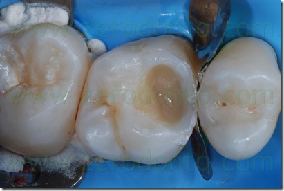 Fig0036Rosti Q1