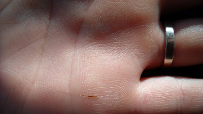 Notice the Felco wound and giant callus