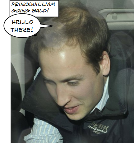 [Prince William Going Bald[3].png]