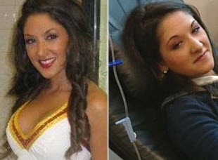 [Desiree Jennings with Dystonia[3].jpg]