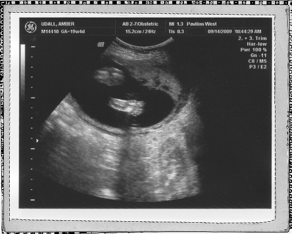 [Ultrasound Boy Foot copy[2].jpg]