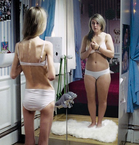 [anorexia-foto-capa[9].jpg]
